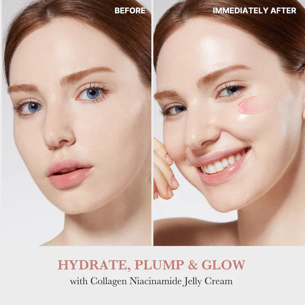 Collagen Device + Collagen Cream